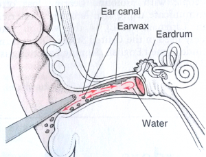 How to take care of your ears