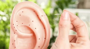 Can acupuncture help to relieve tinnitus, acupuncture and tinnitus