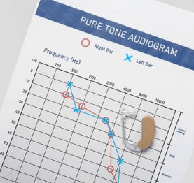 How to understand hearing test results. What is an audiogram